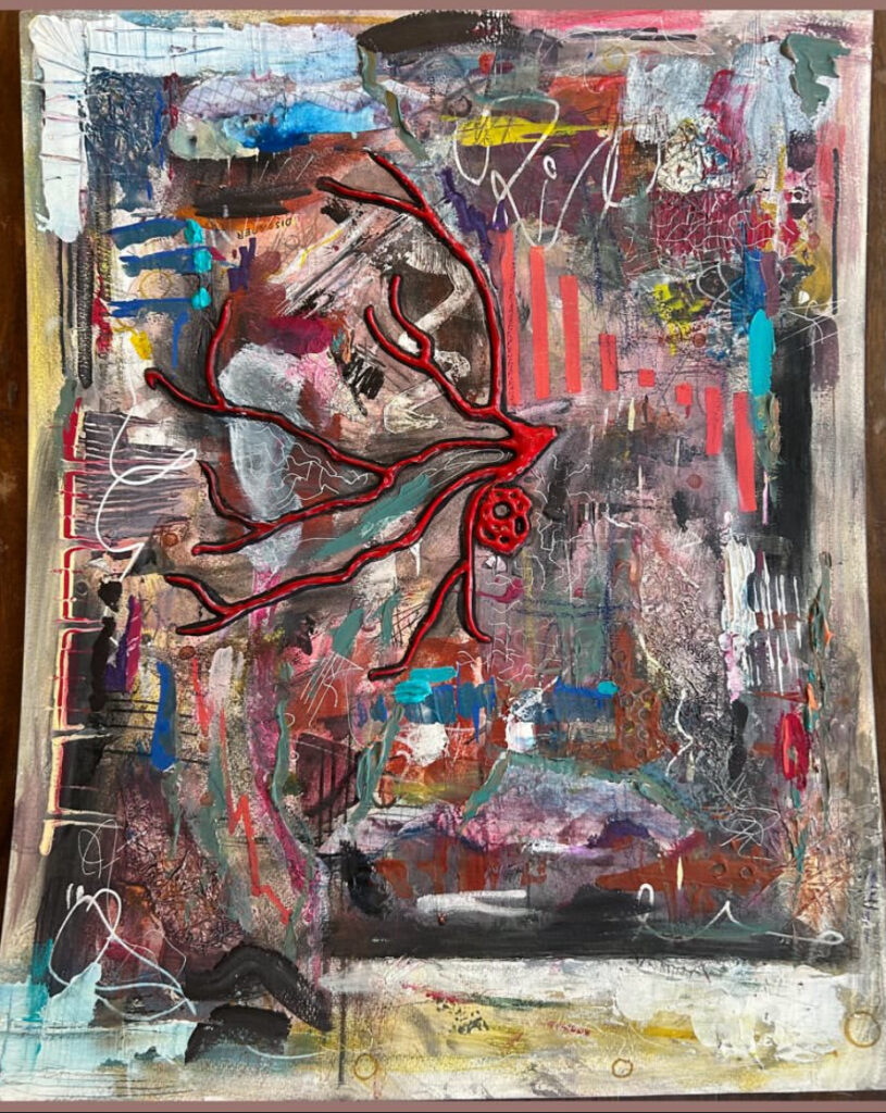 an abstract painting, at the center is a red tumor surrounded by red nerves all in bright red puffy paint. around it is a variety of chaotic textures and mediums, paint, chalk, charcoal, and aluminum foil. the piece is very busy and angry,
